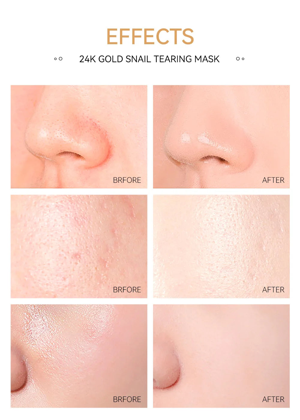24K Gold & Sakura Peeling Face Mask – Anti-Wrinkle, Blackhead Removal & Brightening, 50g