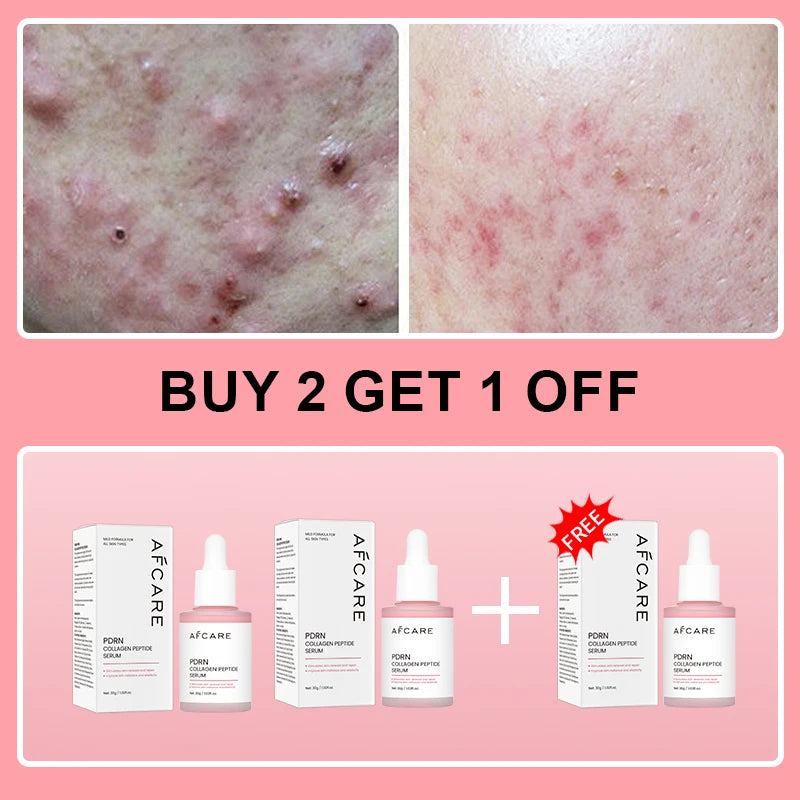 buy 2 free 1 NET WT Collagen Peptide Face Serum With PDRN For Radiant Skin