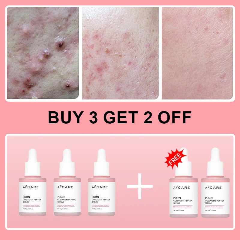 buy 3 free 2 NET WT Collagen Peptide Face Serum With PDRN For Radiant Skin